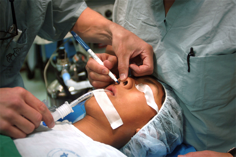 Why you Need to Consider Cosmetic Surgery