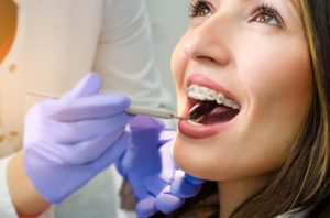 orthodontic care