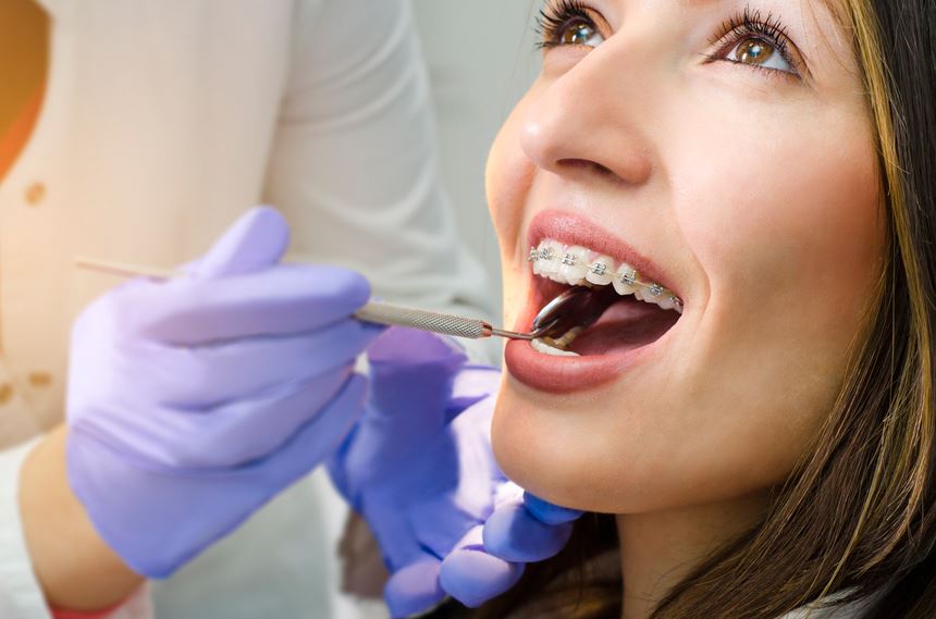 A Guide to Choosing the Right Orthodontist